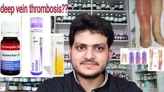 Deep vein thrombosis Homeopathic medicine for Deep vein thrombosis [upl. by Agate]