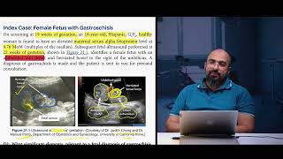 Ep 93 Gastroschisis7series case study counselling  Dr Khaled Salah gastroschisis counselling [upl. by Cyndi]