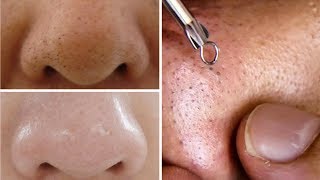 How To Do Facial Clean Up At Home Step By Step For Spotless Clear Skin Rabia Skincare [upl. by Felicie]