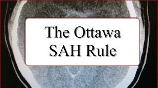 The Ottawa SAH Rule [upl. by Fleeta]