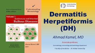 Dermatitis Herpetiformis DH [upl. by Anwahsed]