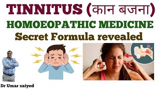 TINNITUS HOMOEOPATHIC MEDICINE SECRET FORMULA [upl. by Keare]