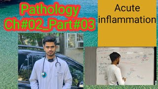 ACUTE INFLAMMATION34PathologyCh02Part03 [upl. by Beatriz590]