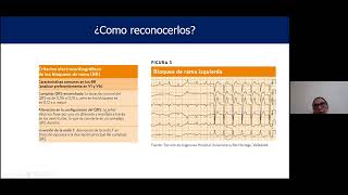 05 BRADIARRITMIAS  ENFERMEDAD DEL NODO  BLOQUEOS AV [upl. by Zoila]