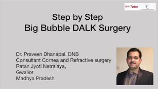 DALK Big Bubble  Step by Step  Dr Praveen Dhanapal [upl. by Bradleigh]