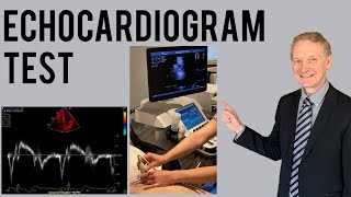 Echocardiogram Procedure  Heart Ultrasound  Everything you need to know [upl. by Keyser22]