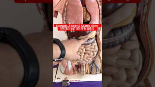 Acidity Gastric Ulcer Peptic Ulcer amp Stomach ऐसिडिटी एवं पेट के छाले कहाँ और कैसे बनते है shorts [upl. by Trixy]