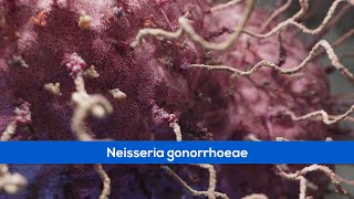 Medical Animations  Bacteria Gonorrhoea [upl. by Eiggep920]