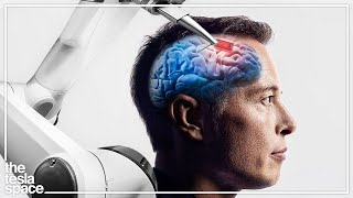 The 2022 Neuralink Update Is Here [upl. by Mackler]