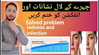 How to solved problem face redness skin Infection problem solved advantan cream [upl. by Ykcim95]