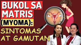 BUKOL sa MATRIS Myoma  Sintomas at Gamutan  By Doc Liza RamosoOng [upl. by Atnas]