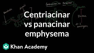 Centriacinar emphysema vs panacinar emphysema  NCLEXRN  Khan Academy [upl. by Aloivaf5]