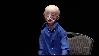 My philosophy for a happy life  Sam Berns  TEDxMidAtlantic [upl. by Tiossem]