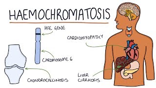 Understanding Haemochromatosis [upl. by Lletnahc]