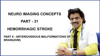 NEUROIMAGING CONCEPTS PART31PART 6HEMORRHAGIC STROKE ARTERIOVENOUS MALFORMATION OFTHE BRAINAVM [upl. by Nroht721]