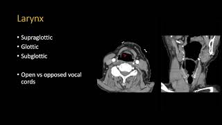 Neck CT search pattern [upl. by Wu]