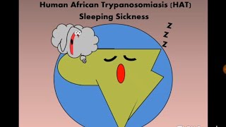 Human African Trypanosomiasis HAT Tbrucei مرض النوم [upl. by Atiluap232]