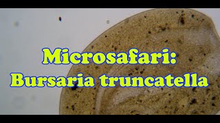 Microsafari Bursaria truncatella [upl. by Pinzler367]