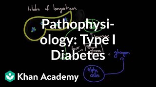 Pathophysiology  Type I diabetes  Endocrine system diseases  NCLEXRN  Khan Academy [upl. by Eimmot]