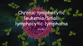 Chronic lymphocytic leukemiaSmall lymphocytic lymphoma CLLSLL [upl. by Smaj]