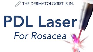 VBeam amp PDL Lasers for Rosacea  Dermatologist Explains [upl. by Polloch]