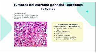 Neoplasias testiculares [upl. by Alyam]