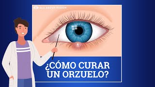 Cirugía Ocular LASIK [upl. by Hailed]