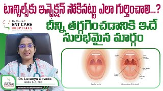 టాన్సిల్స్‌ ఎలా గుర్తించాలి  Tonsillitis  Symptoms Causes  Dr Harika ENT Care Hospital [upl. by Aneehsyt]