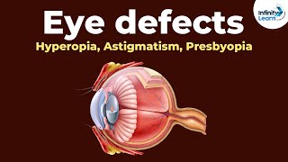 Eye defects  Hyperopia Astigmatism Presbyopia  Dont Memorise [upl. by Mylander419]