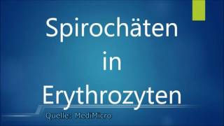 Intraerythrozytäre Parasiten  Borrelien in roten Blutkörperchen [upl. by Nnaylime]