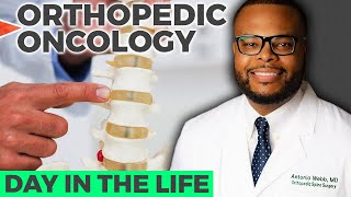 Day In The Life of Orthopedic Oncology [upl. by Crin]