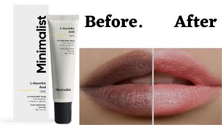 How to remove lip pigmentation Minimalist lip treatment balm review [upl. by Toback592]