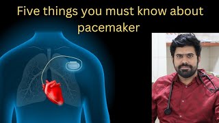 Five important facts about pacemakers you need to know  Doctor aditha cibi [upl. by Yeliah]