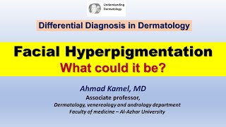 Facial hyperpigmentation What could it be [upl. by Sauers]