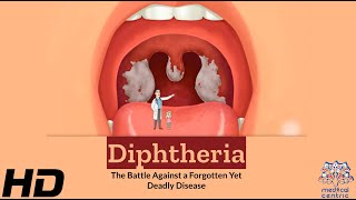 Diphtheria The Silent Battle Against a Deadly Disease [upl. by Aicilanna940]