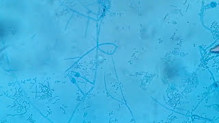 Penicillium growth and its structures under the microscope [upl. by Cirek]