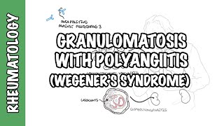 Granulomatosis with Polyangiitis pathophysiology symptoms treatment [upl. by Dnomhcir]