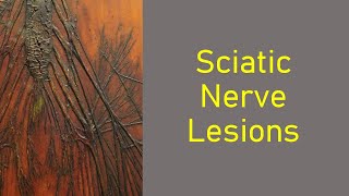 Sciatic Nerve Lesions Part 1 [upl. by Enihpets11]