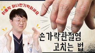 손가락관절염  손가락통증 집에서 이렇게만 하셔도 충분히 좋아져요 믿고 따라하기 [upl. by Analeh]