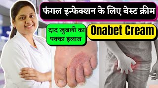 Onabet Cream  Sertaconazole Nitrate Cream 2 WW  Antifungal Cream  Onabet Cream Kis Kaam Aati Hai [upl. by Niltak]