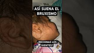 ¿Tu HIJOA RECHINA los DIENTES al DORMIR 📢 Así suena el BRUXISMO INFANTIL [upl. by Eremihc]