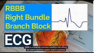 Understanding Right Bundle Branch Block RBBB on ECG Causes Symptoms and Treatment [upl. by Aneer]