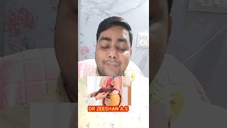 लीवर की गर्मी का इलाज सिर्फ 1सीरप Just 1 syrup cures liver heatliverkisujan Liverviraviralshort [upl. by Nelrsa]