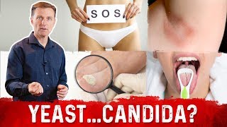 Yeast Infection vs Candida Infection Is there a Difference – DrBerg [upl. by Sieber73]