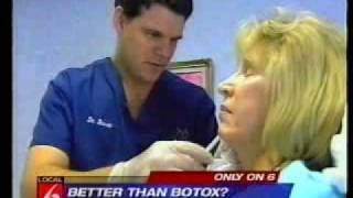 Sculptra quotLiquid Faceliftquot Dr Roger Bassin Orlando Florida [upl. by Attenauq]