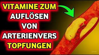 Entfernen Sie Arterienplaques auf natürliche Weise mit 6 kraftvollen Vitaminen [upl. by Mcmath]