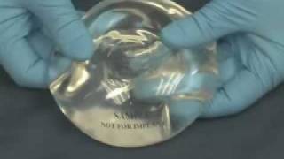 Durability of Saline amp Silicone Breast Implants [upl. by Dorthy]