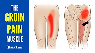 The Groin Pain Muscle How to Release It for INSTANT RELIEF [upl. by Gabrila760]