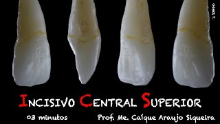 Incisivo Central Superior  Teoria  Características Principais  Anatomia Dental [upl. by Jezabella]