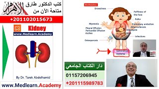 Nephrotic Syndrome cme internalmedicine usmle medical محاضراتباطنة [upl. by Toddy]